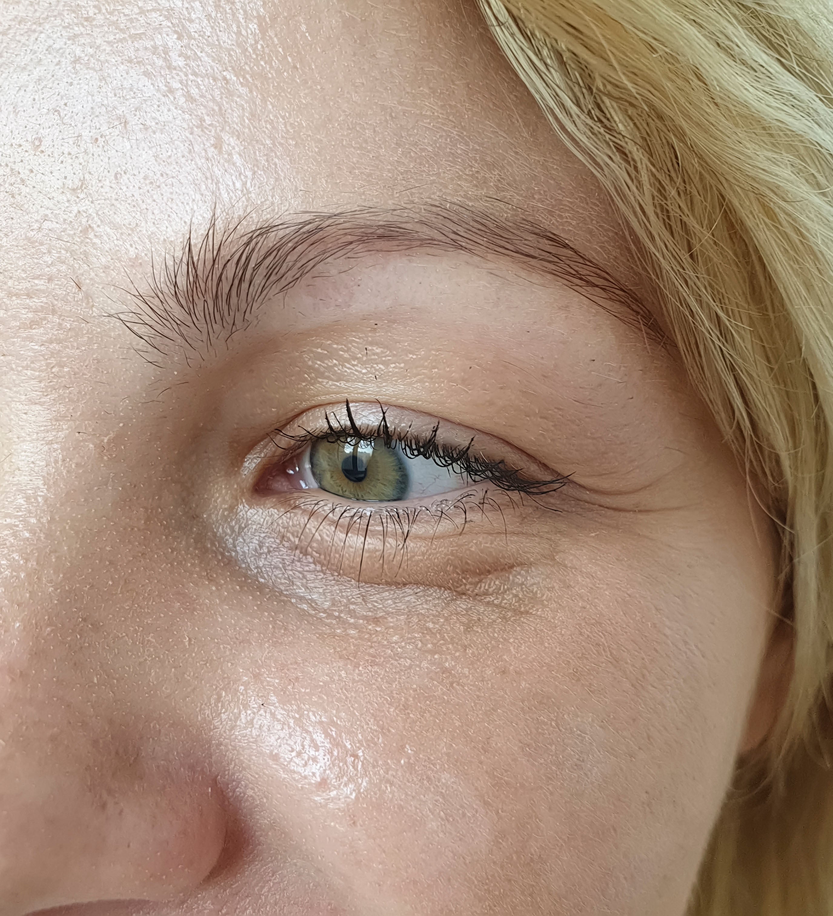 Dry, dehydrated skin around the eye — before The Art of Tallow Whipped Tallow Moisturizer